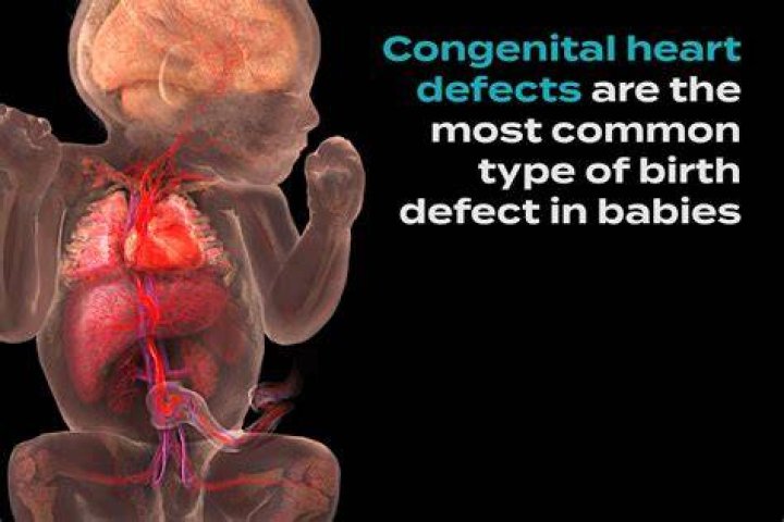 Discoveries And Insights For Congenital Heart Defects