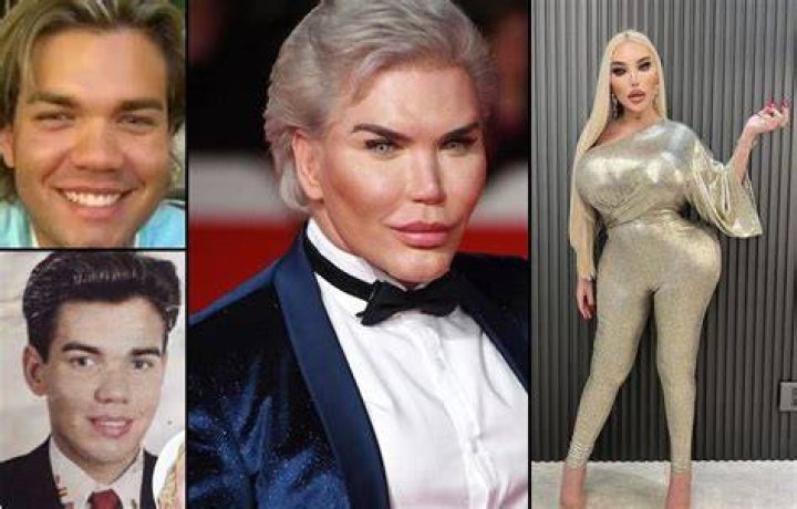Who is Jessica Alves? Human Ken Doll talks life after surgery on This Morning Mon 13 July